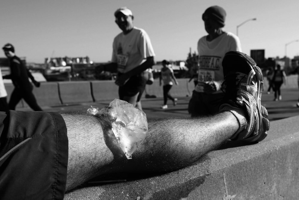 Top 10 Running Injuries and How to Treat Them Part 1 PhysioRoom Blog