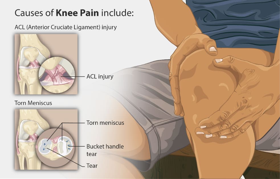 Infographic of knee pain causes