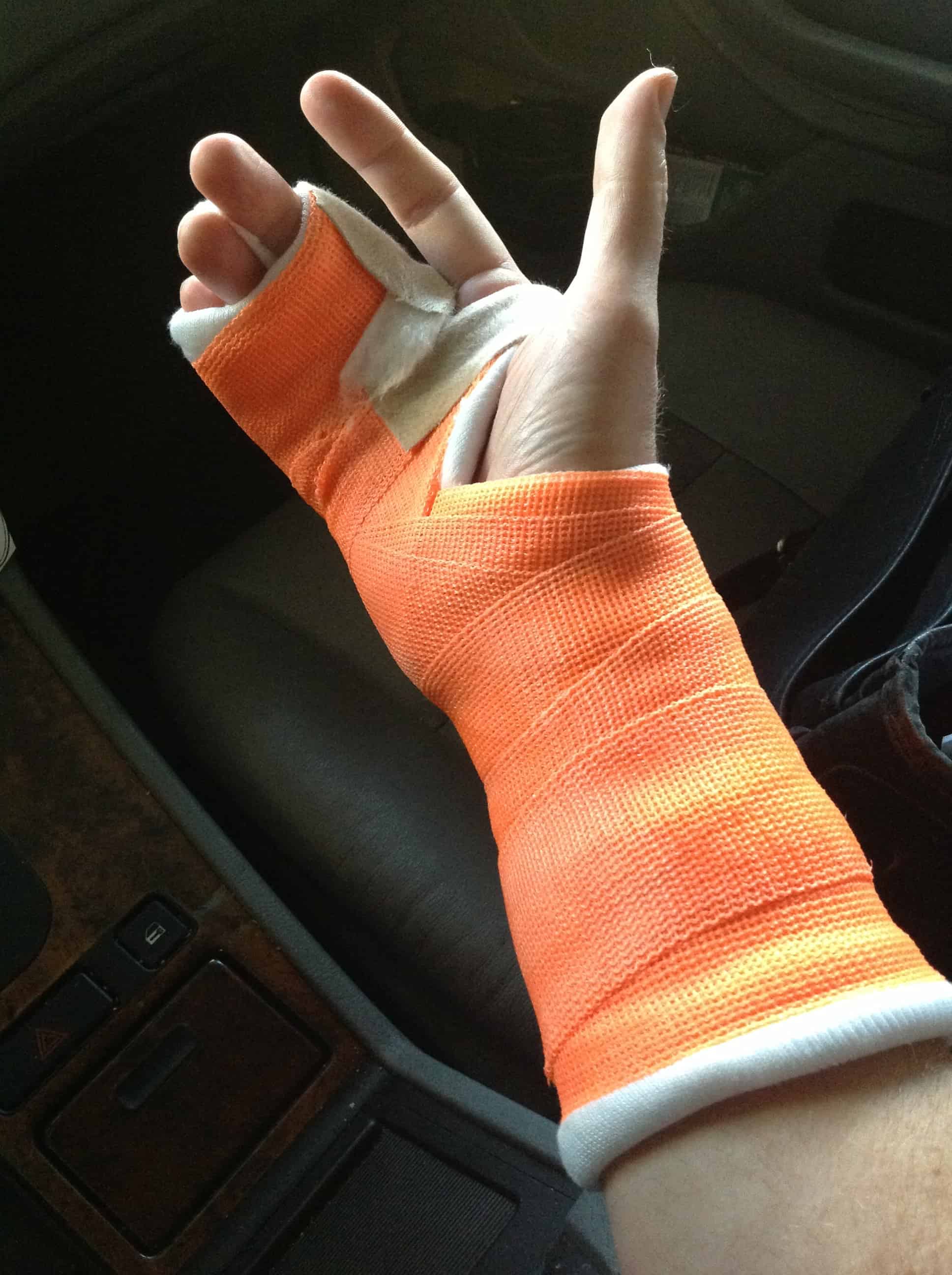 how-to-treat-a-sprained-finger-physioroom-blog